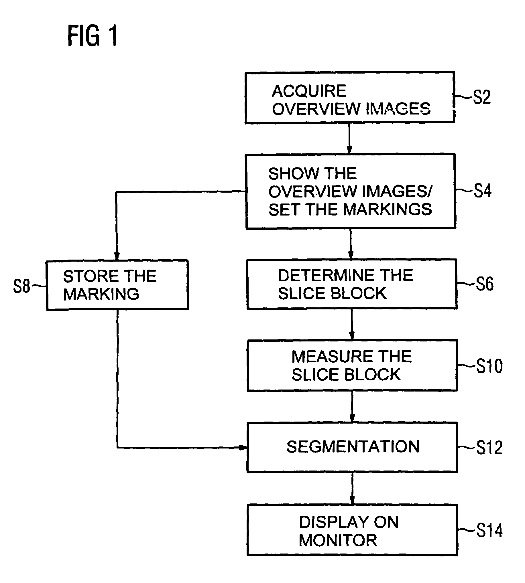 Method for segmenting a medical data set