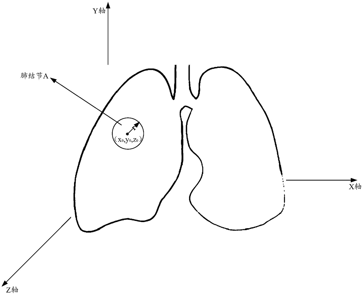 Method and device for analyzing pulmonary nodules