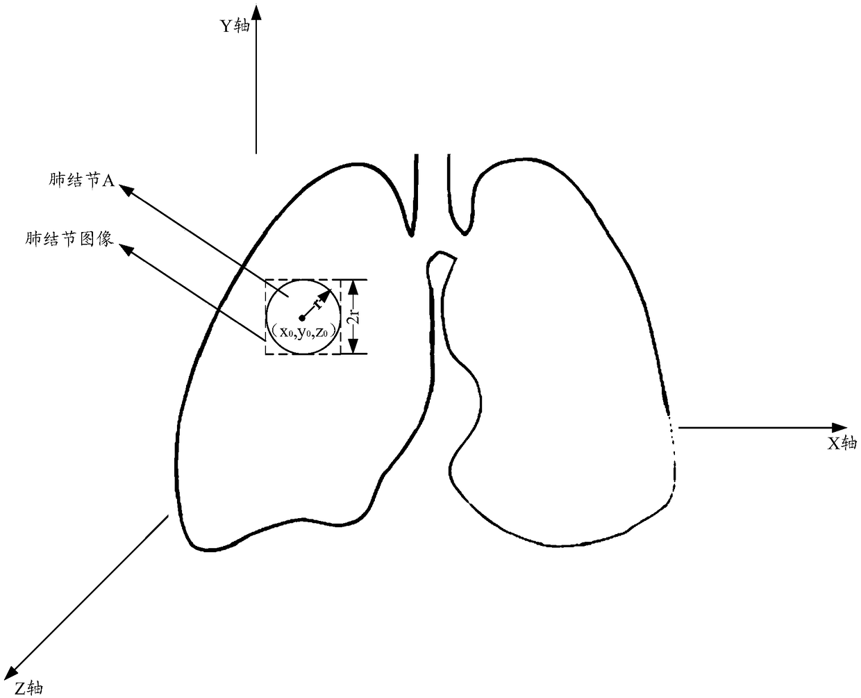 Method and device for analyzing pulmonary nodules
