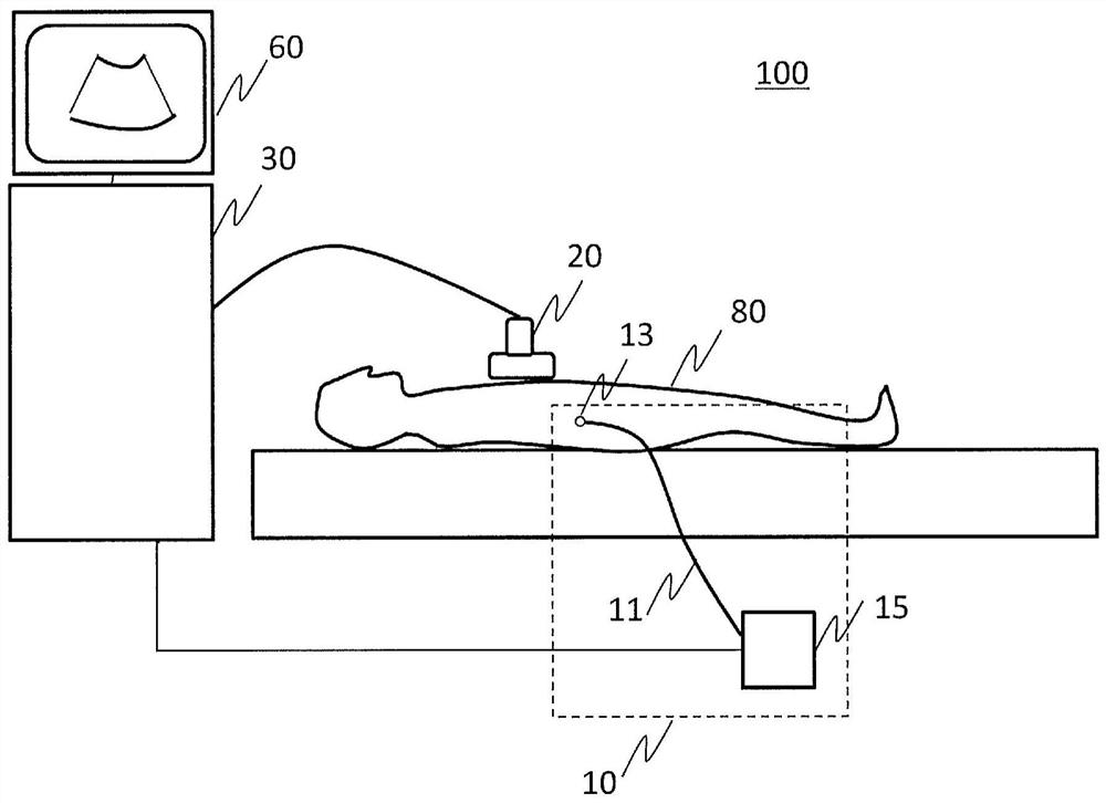 Ultrasonic imaging device, treatment support system, and image processing method