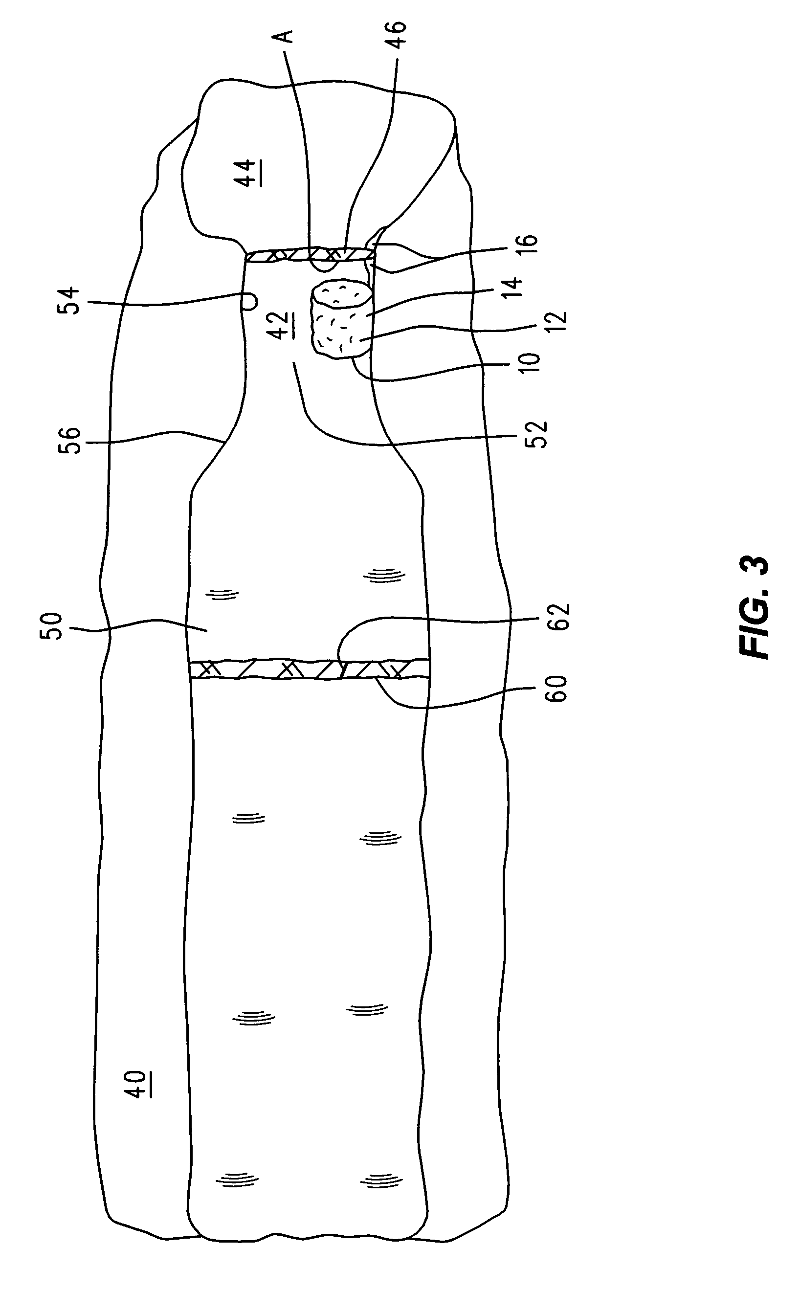 Controlled release system for delivering therapeutic agents into the inner ear
