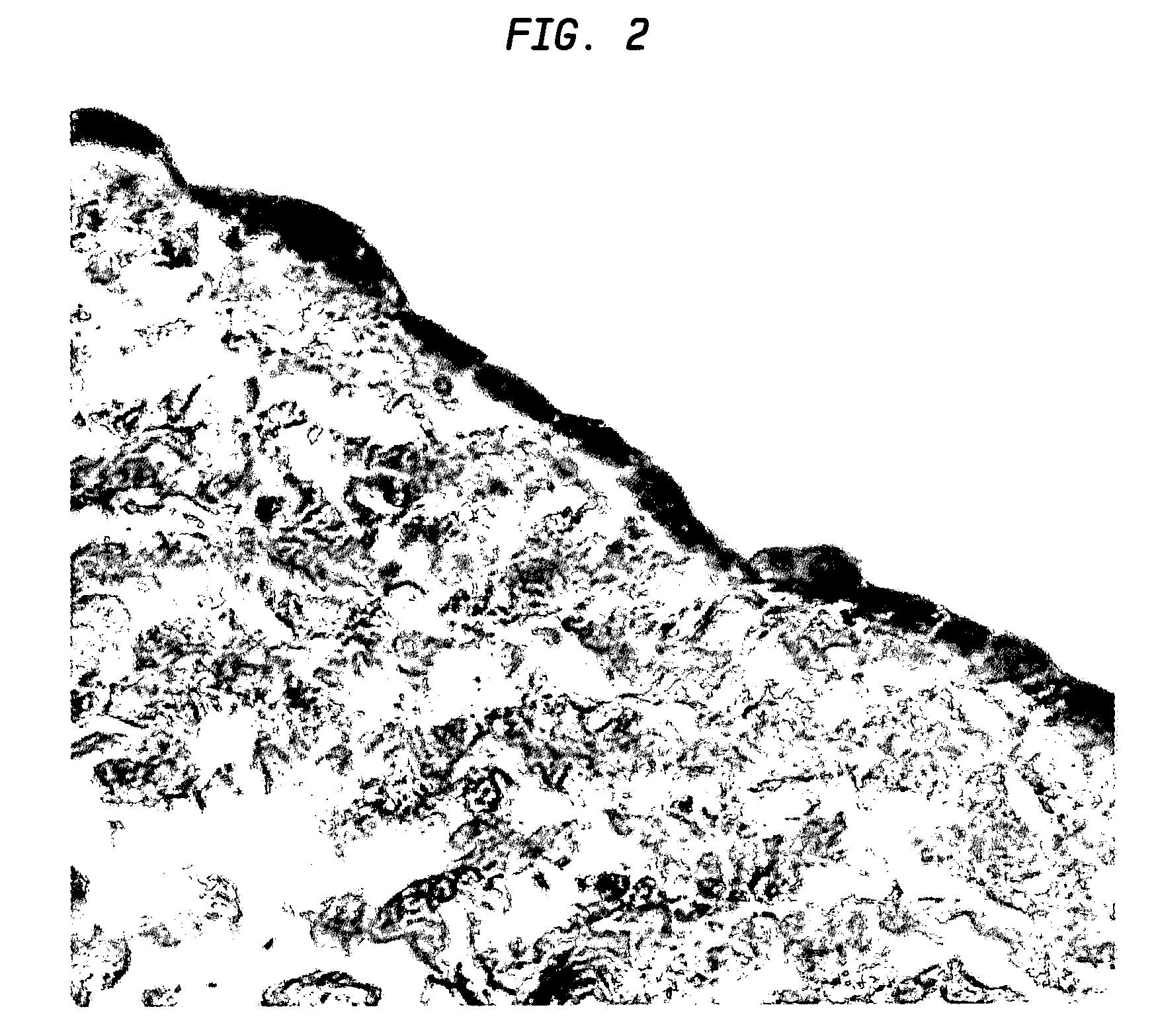 Extracellular matrix cancer vaccine adjuvant