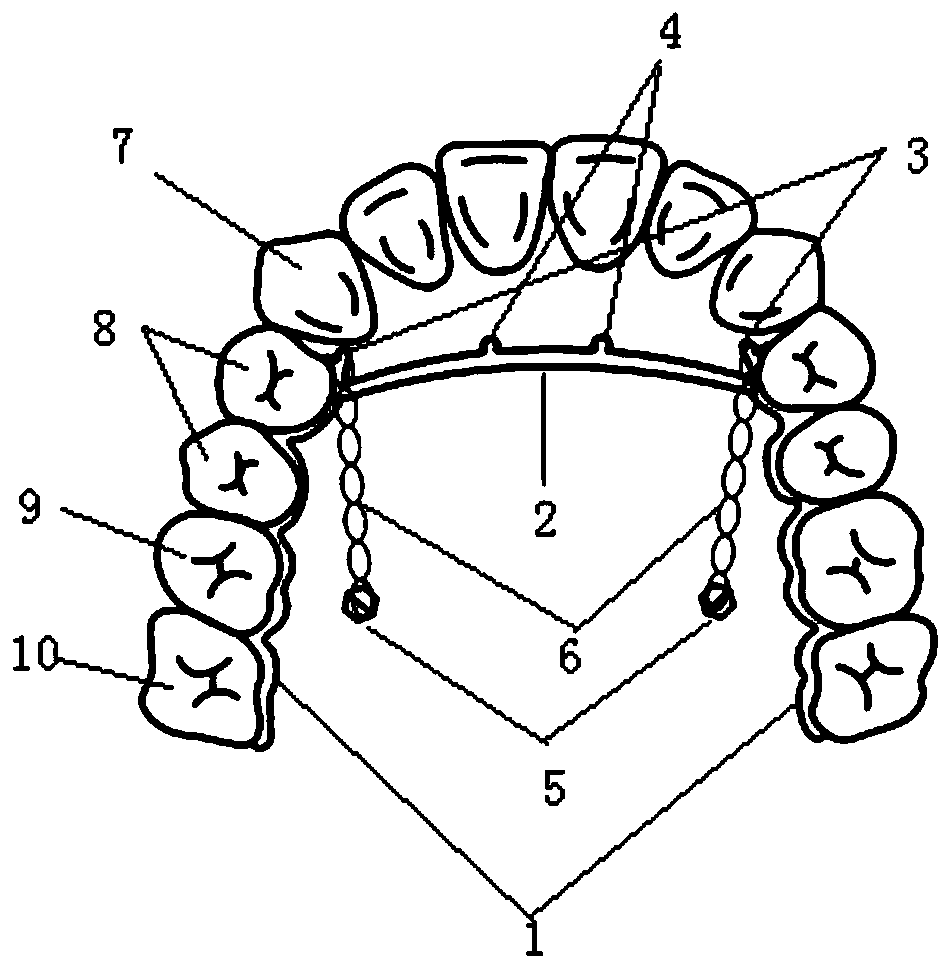 One-piece molar-back-pushing device
