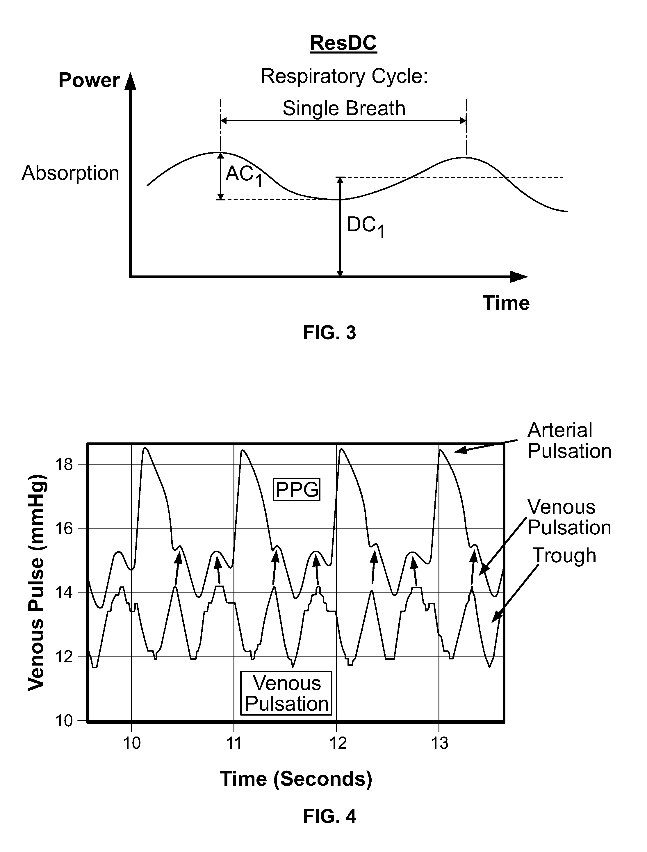 Systems and Methods Utilizing Plethysmographic Data for Distinguishing Arterial and Venous Oxygen Saturations