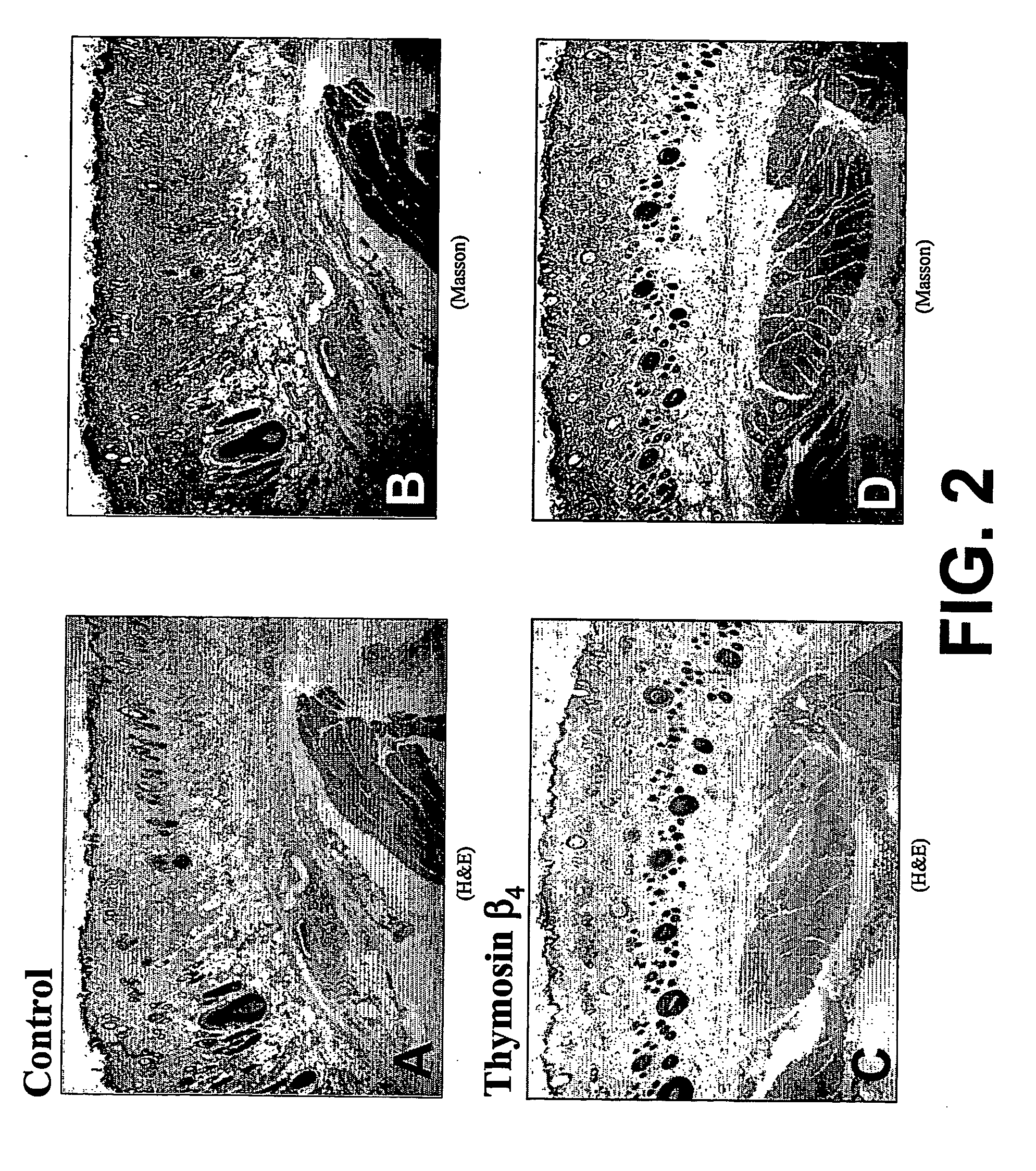 Methods and compositions for the promotion of hair growth utilizing actin binding peptides