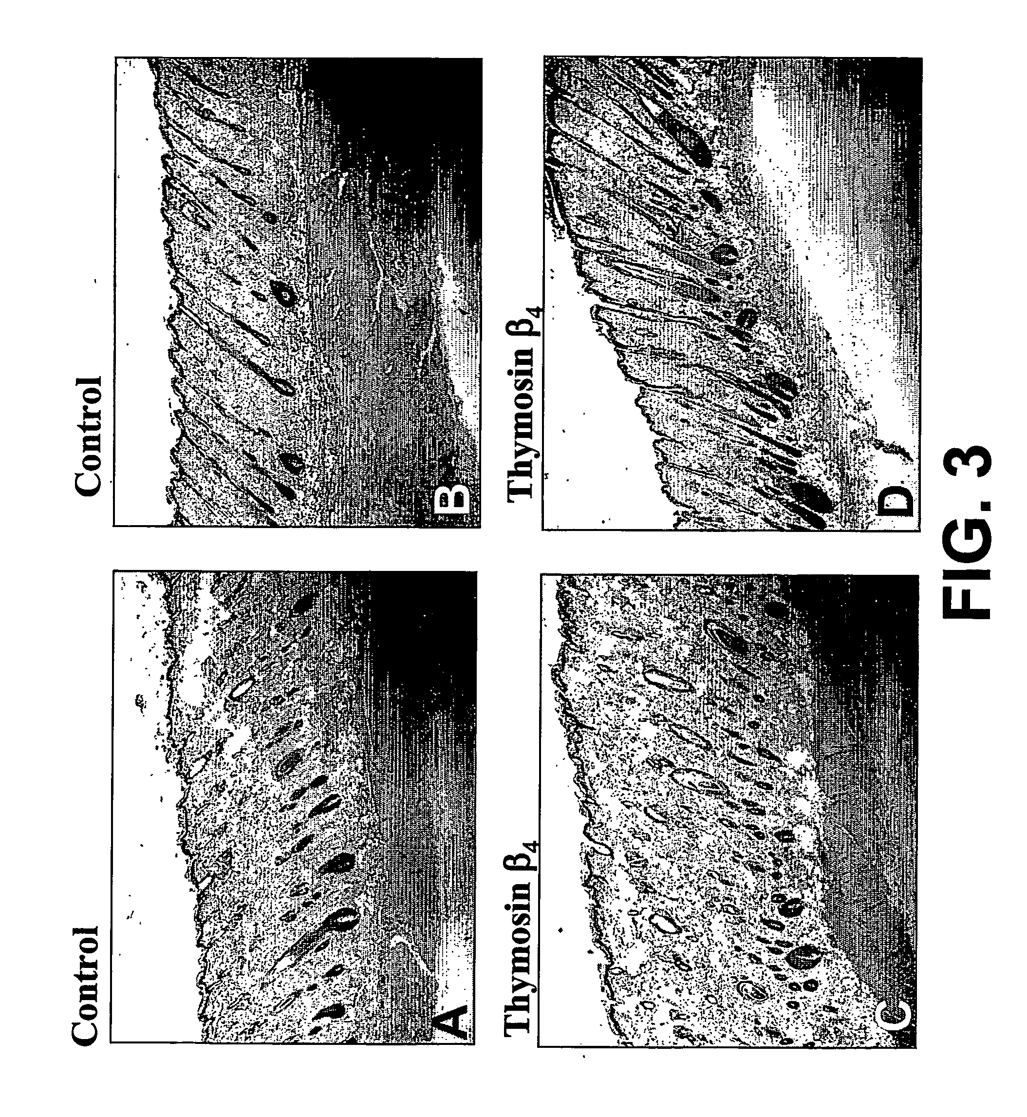 Methods and compositions for the promotion of hair growth utilizing actin binding peptides