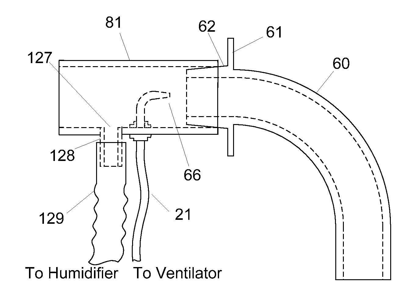 Methods and devices for providing mechanical ventilation with an open airway interface
