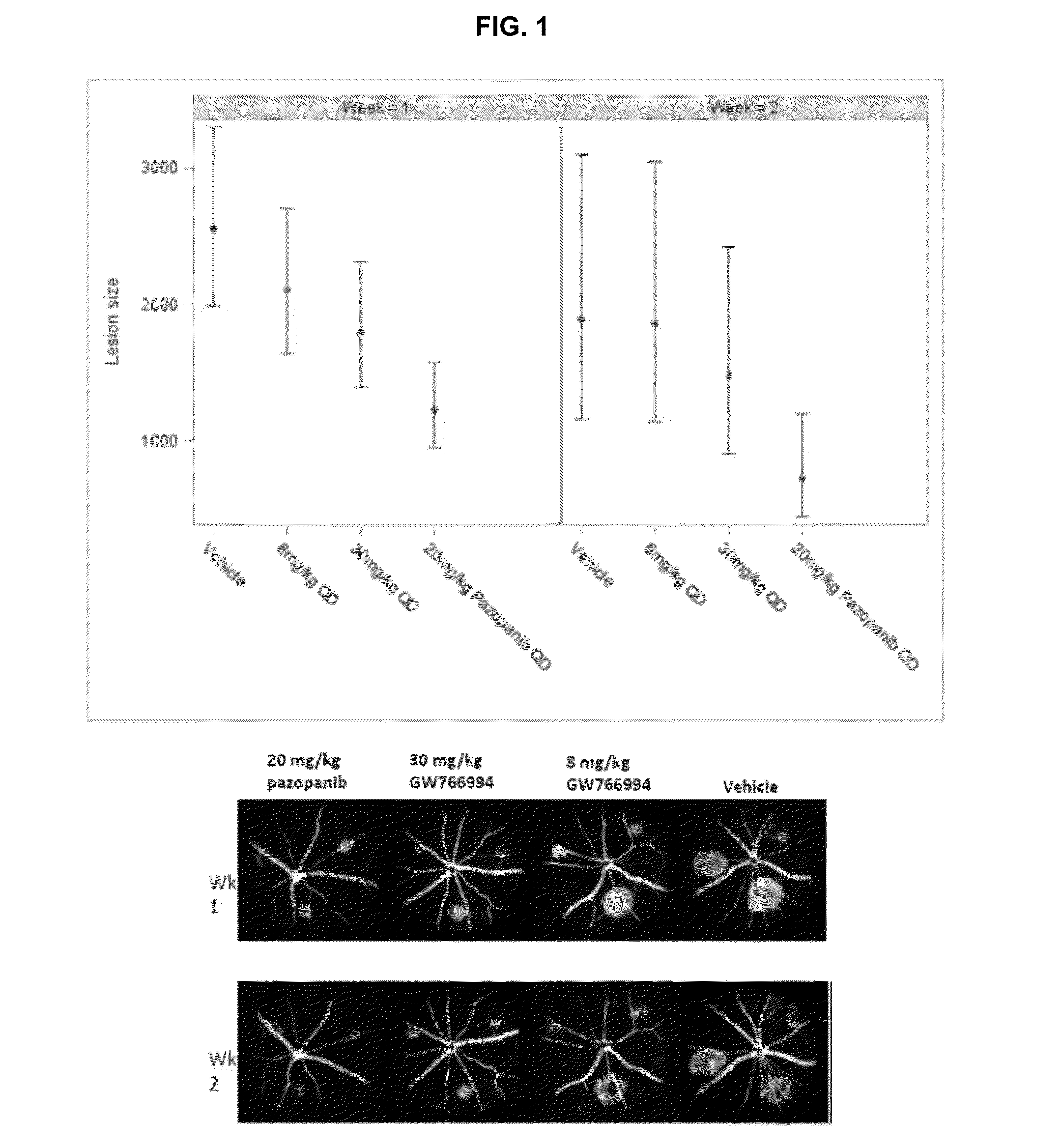 Methods of treatment and prevention of eye diseases