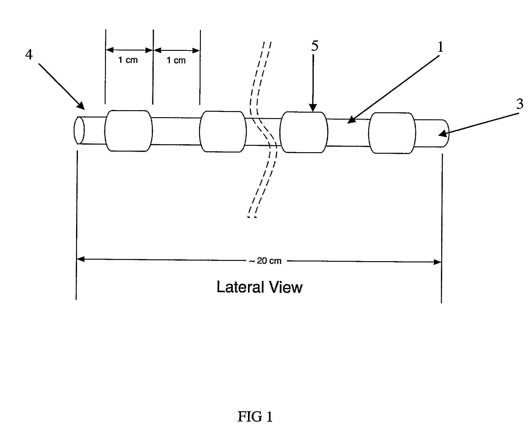 Non-Coagulative Vascular Shunt