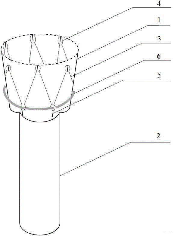 Inner coverage membrane for duodenum