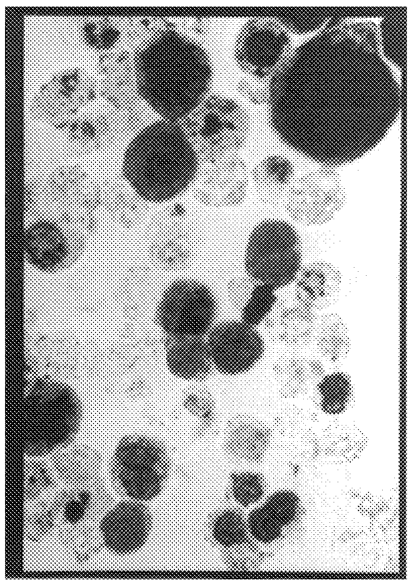 Method of differentiating erythrocyte progenitor cells