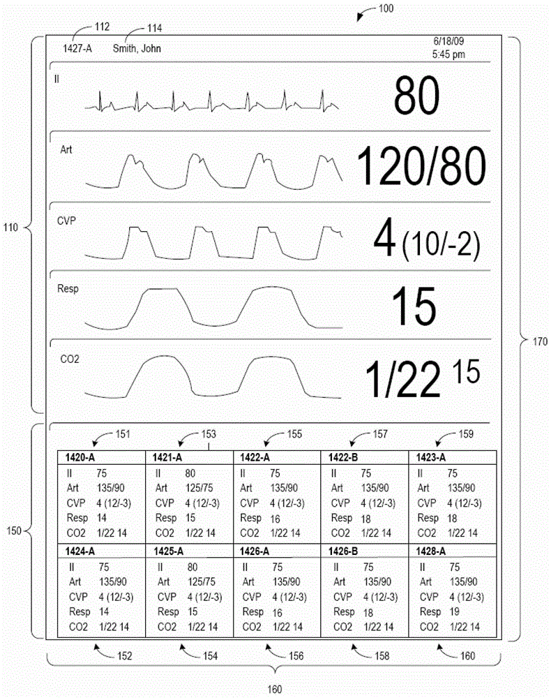 Remote monitoring method and system