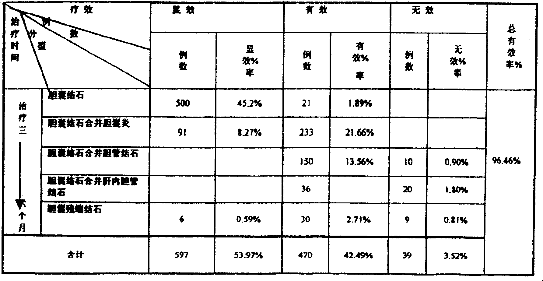 Medicine for treating cholecystolithiasis and preparation process thereof