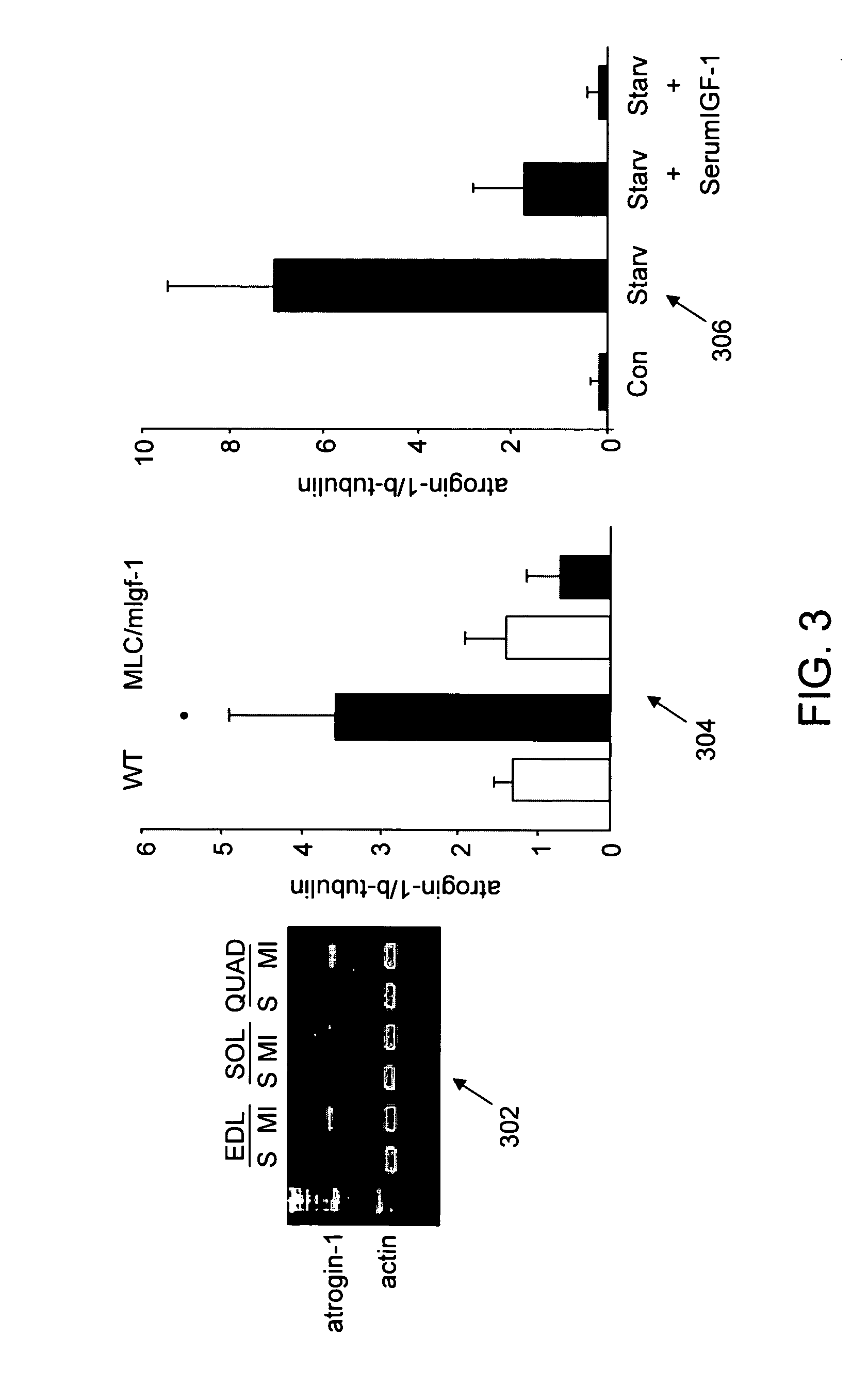 IGF-1 novel peptides