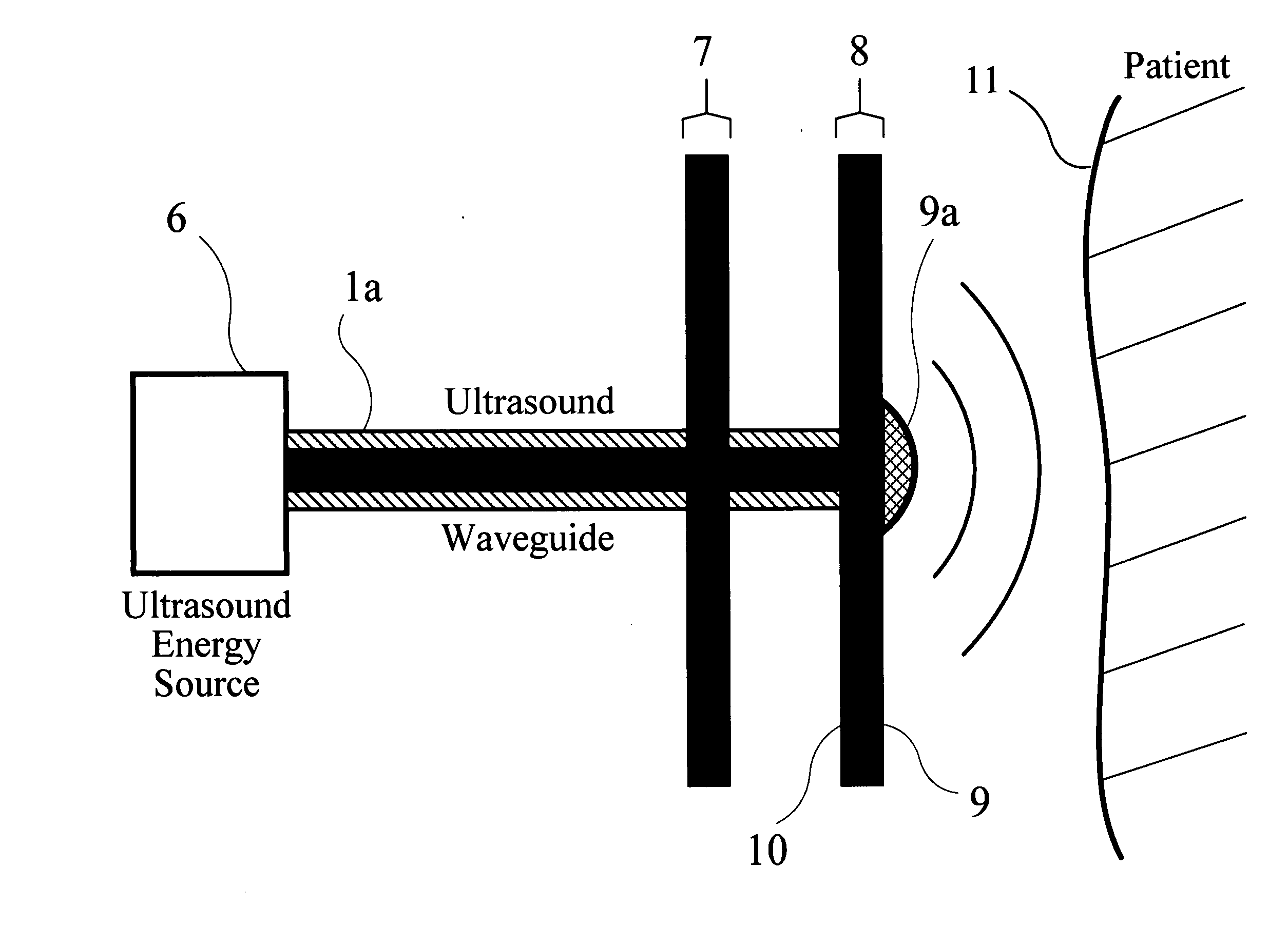 Ultrasonic apparatus and method for treating obesity or fat-deposits or for delivering cosmetic or other bodily therapy