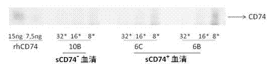 ELISA test kit of human-derived soluble CD74 protein and detection method thereof