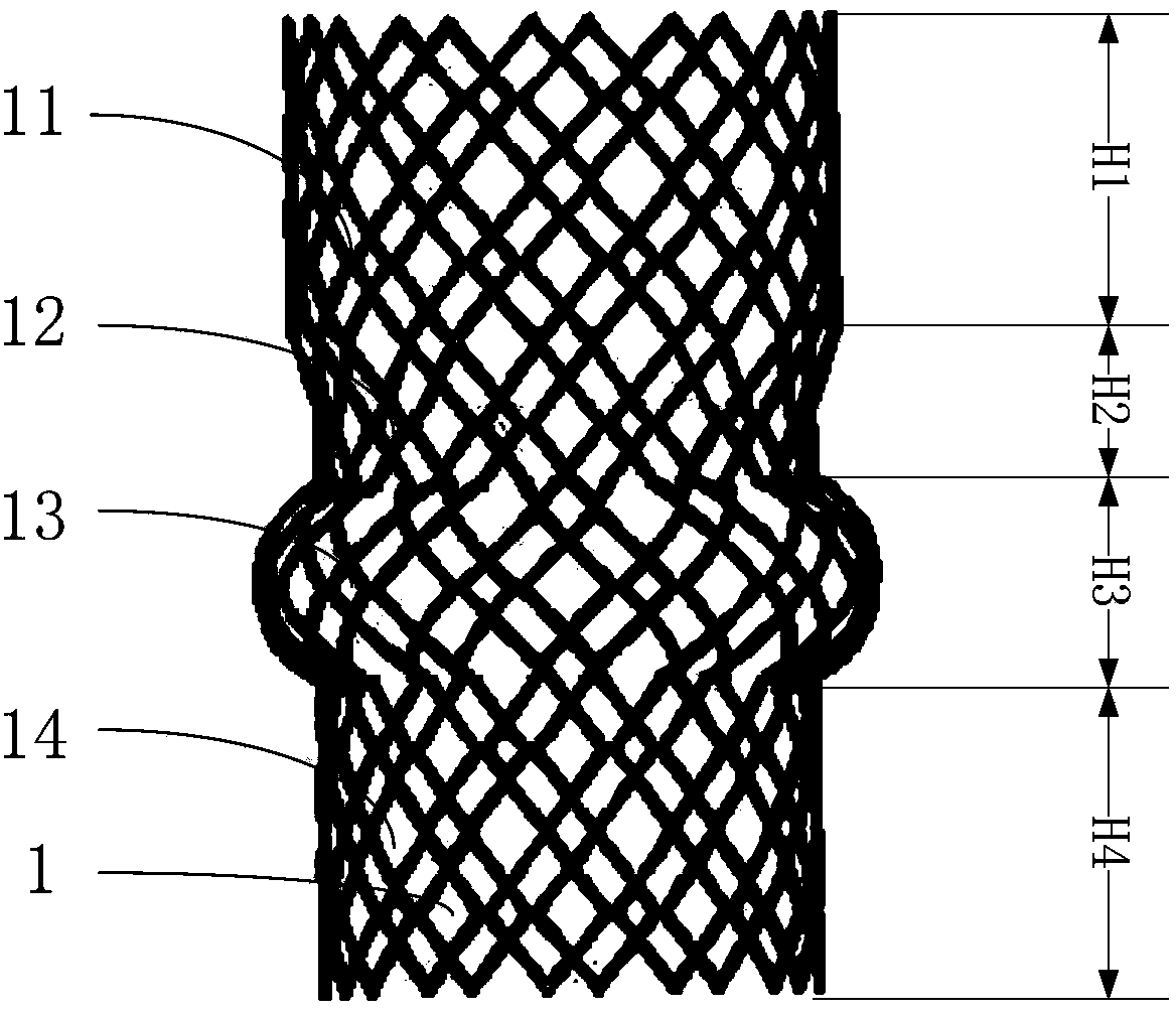 Liquid injection type cage ball aortic valve support system