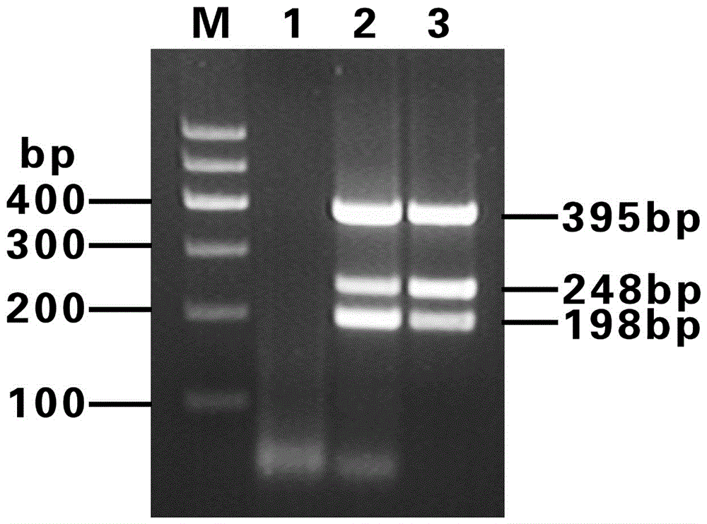 Method for synchronously detecting three viruses of lily by immunocapture triple RT-PCR (reverse transcription-polymerase chain reaction)