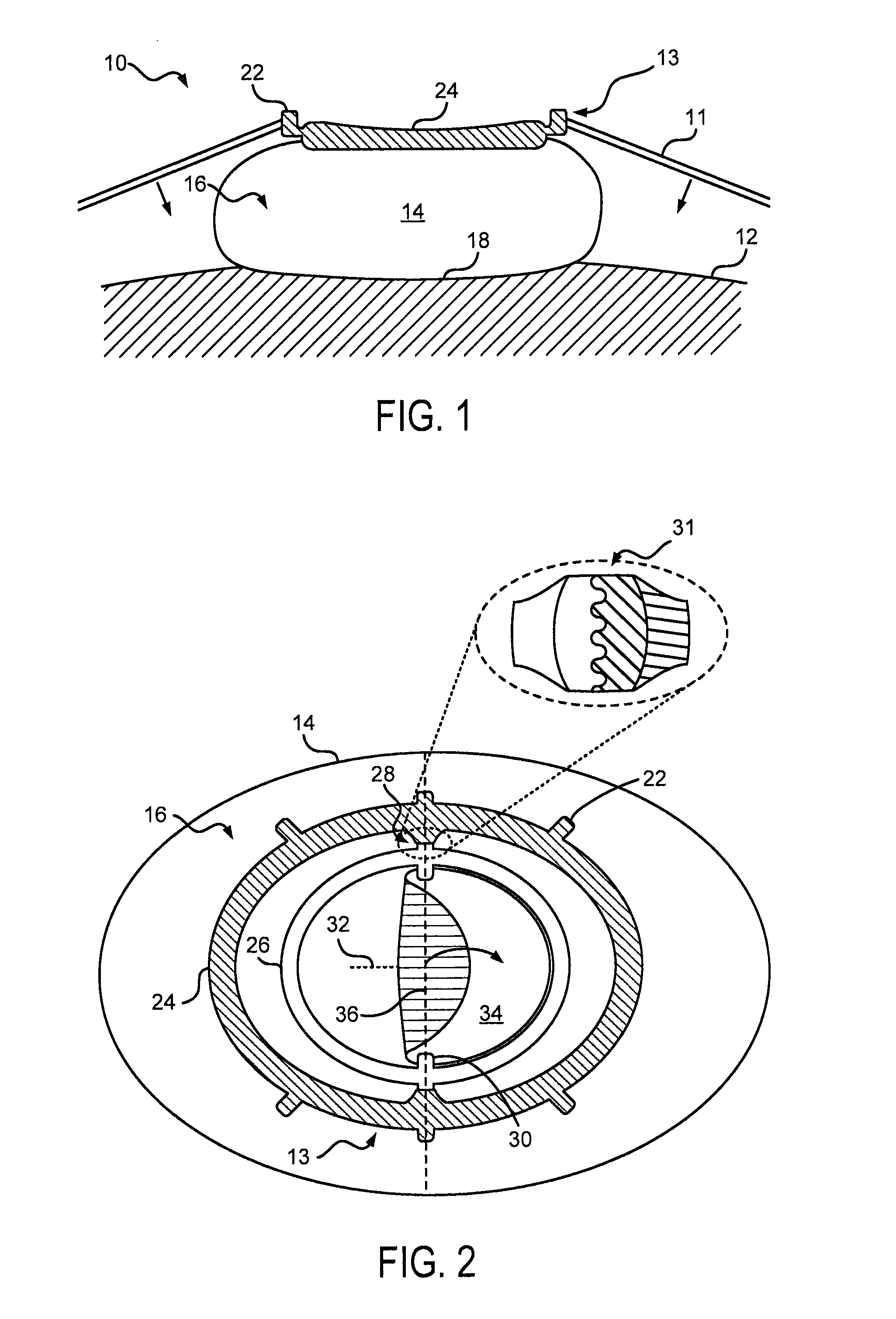 System and Method for Fetal Heart Monitoring Using Ultrasound