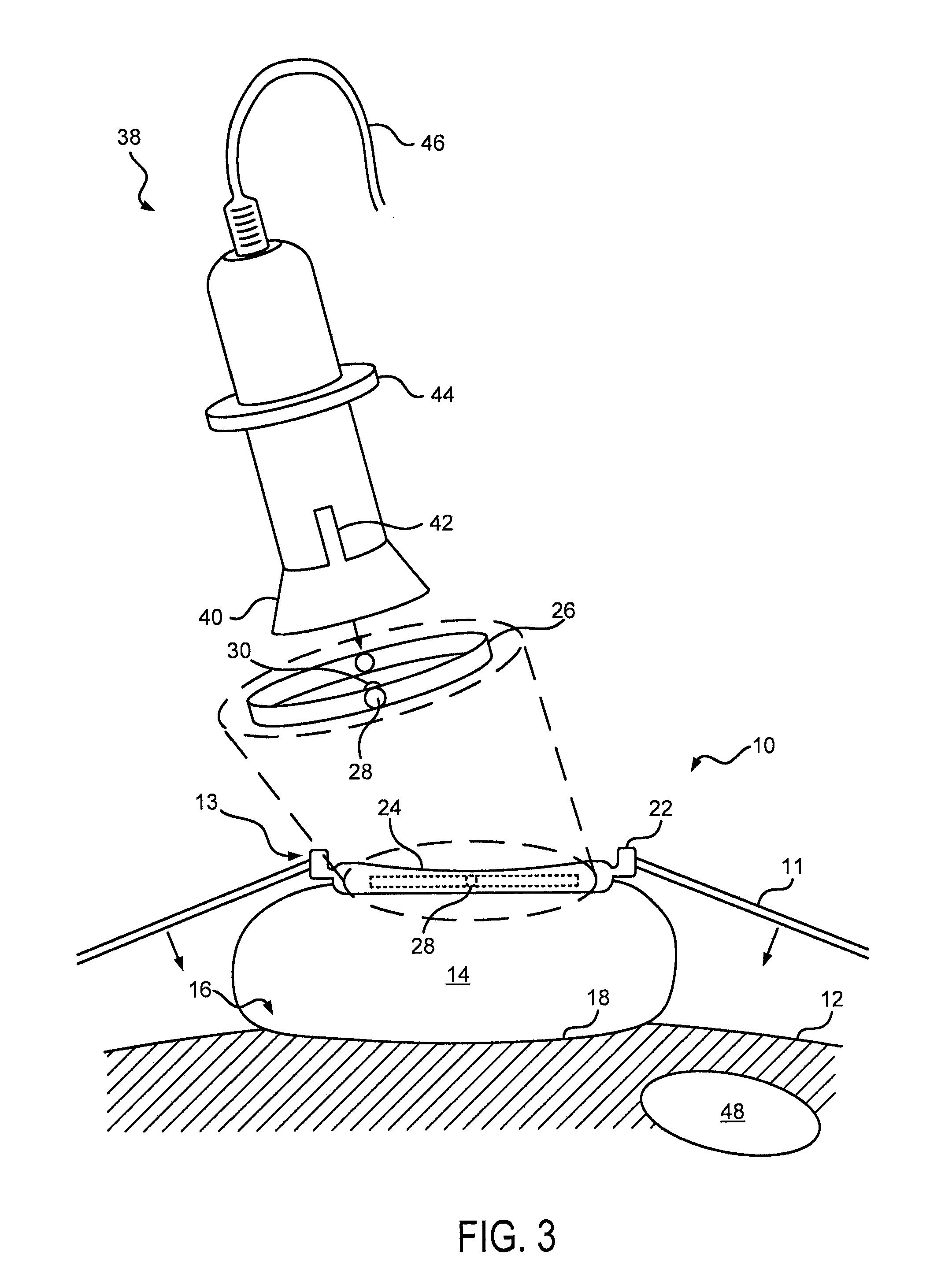 System and Method for Fetal Heart Monitoring Using Ultrasound