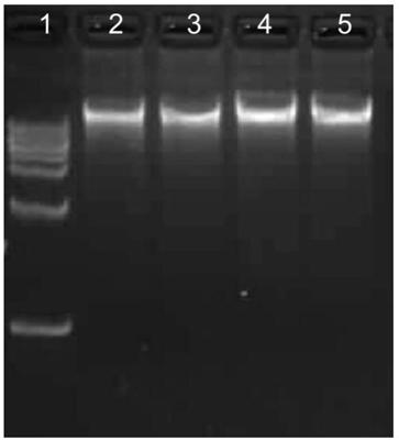 Bacterial lysate and kit for extracting plasmid DNA and method for extracting plasmid DNA