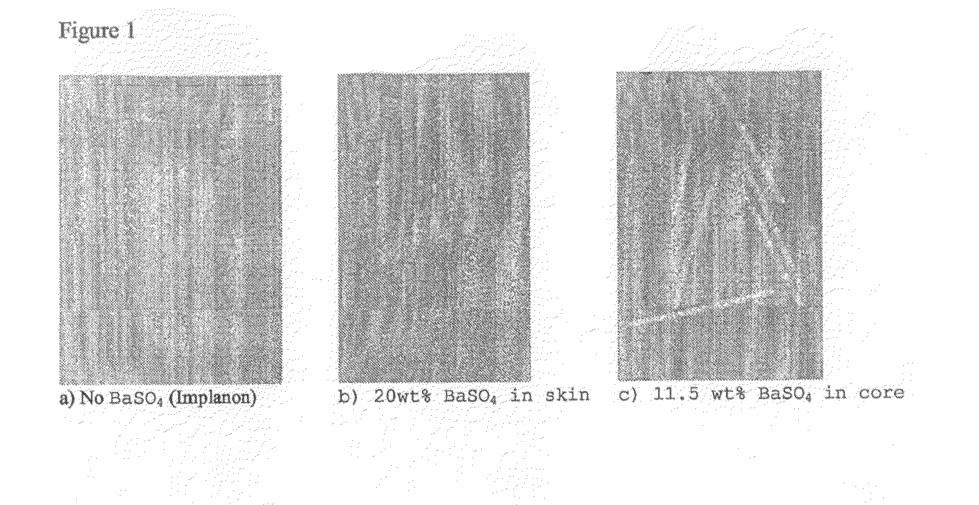 X-Ray Visible Drug Delivery Device