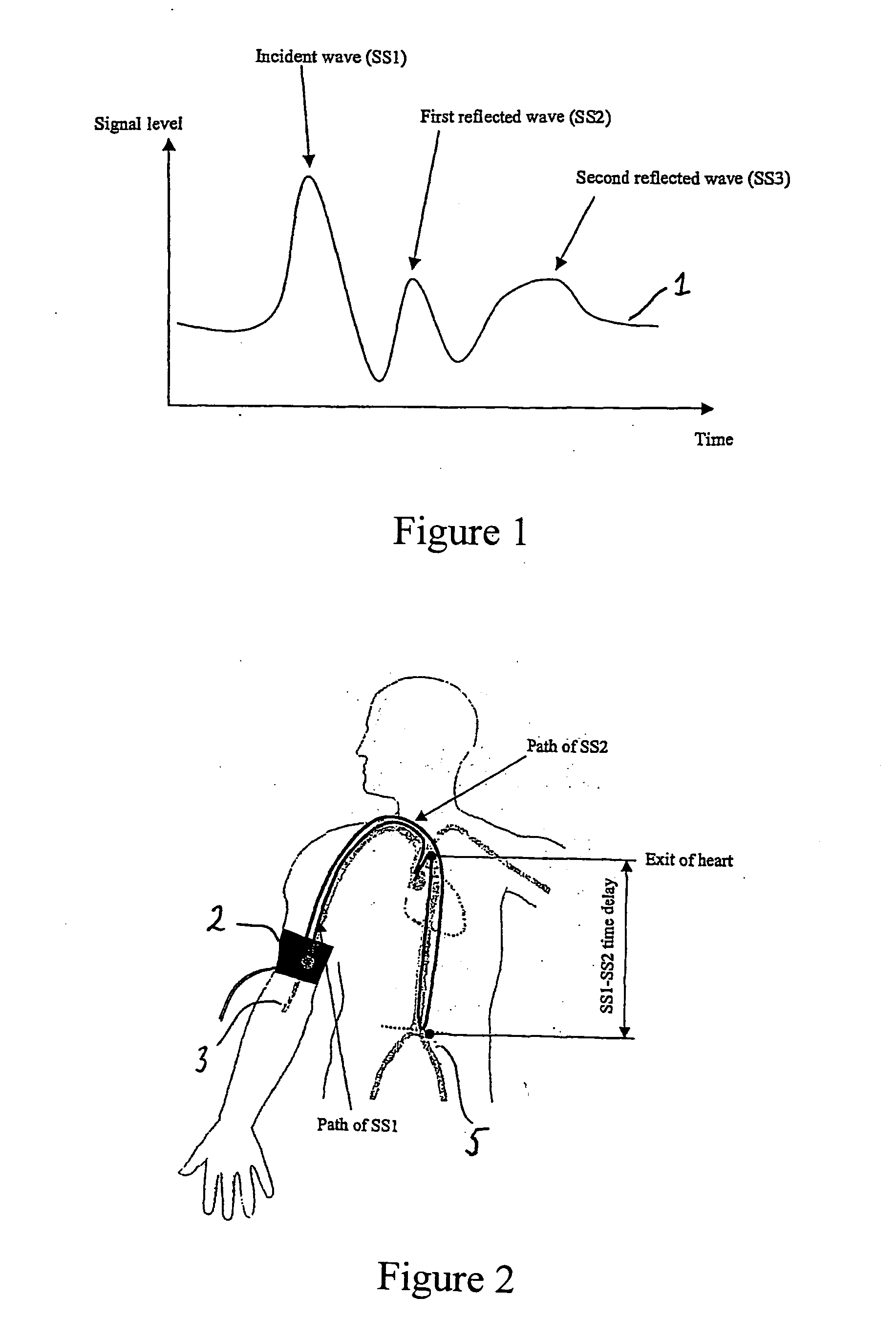 System and method for non-invasive cardiovascular assessment from supra-systolic signals obtained with a wideband external pulse transducer in a blood pressure cuff