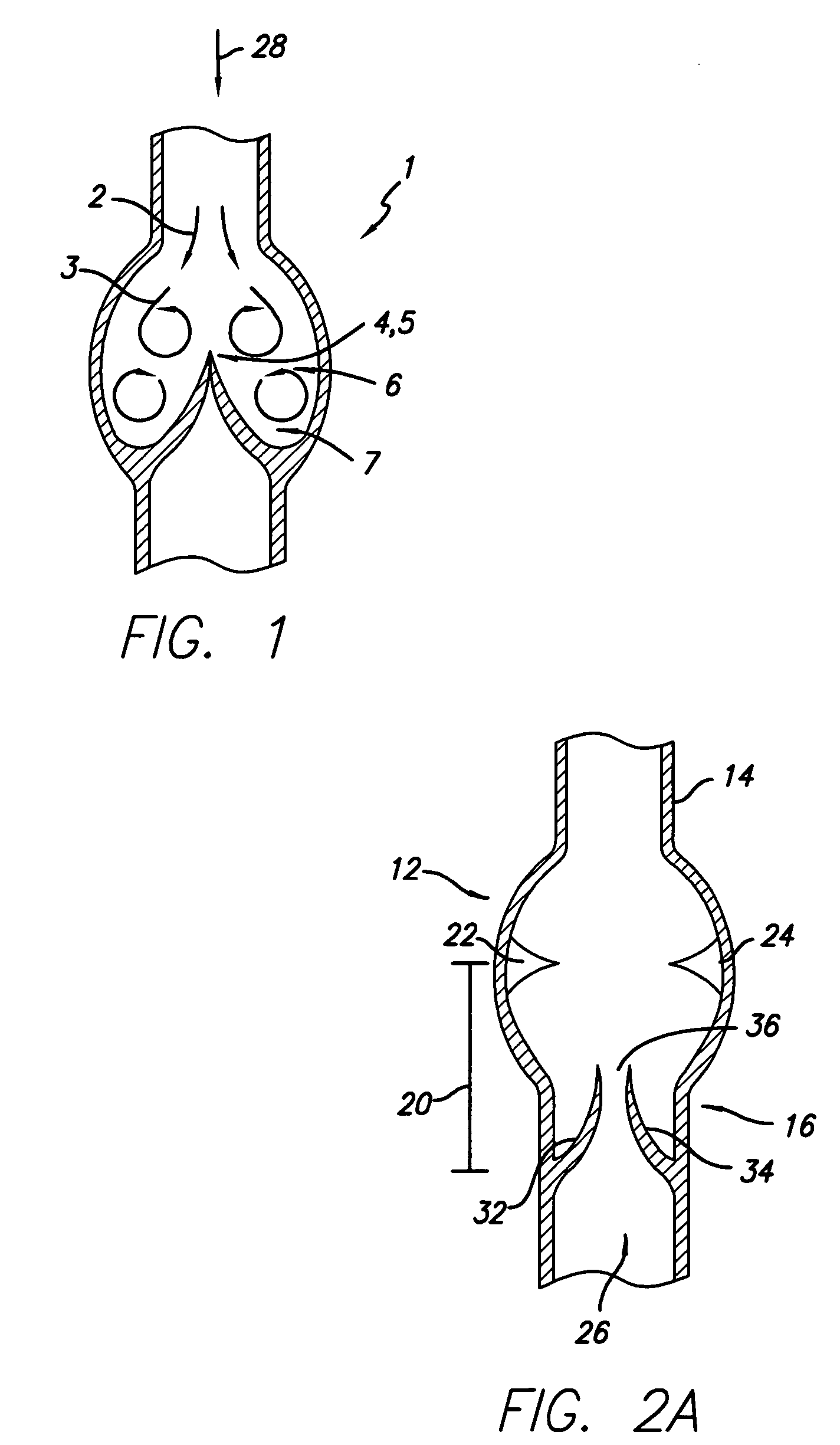 Method for implanting prosthetic valves