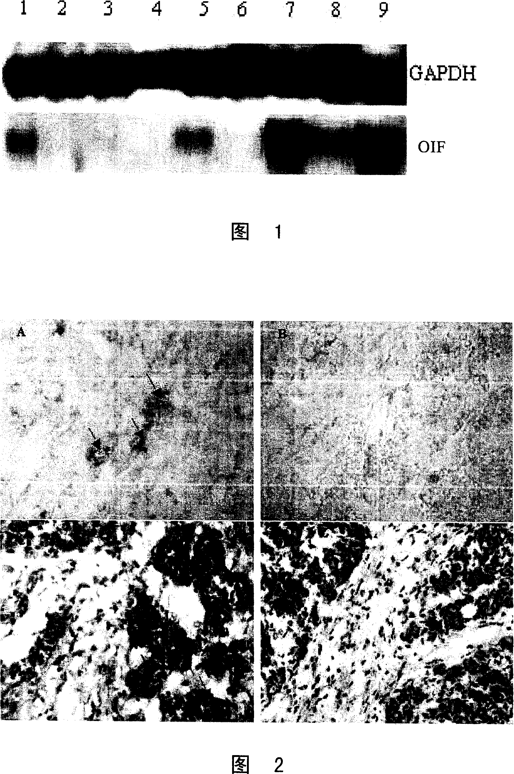 Monoclonal antibody for resisting human osteogenesis induction factor and its preparation method and uses