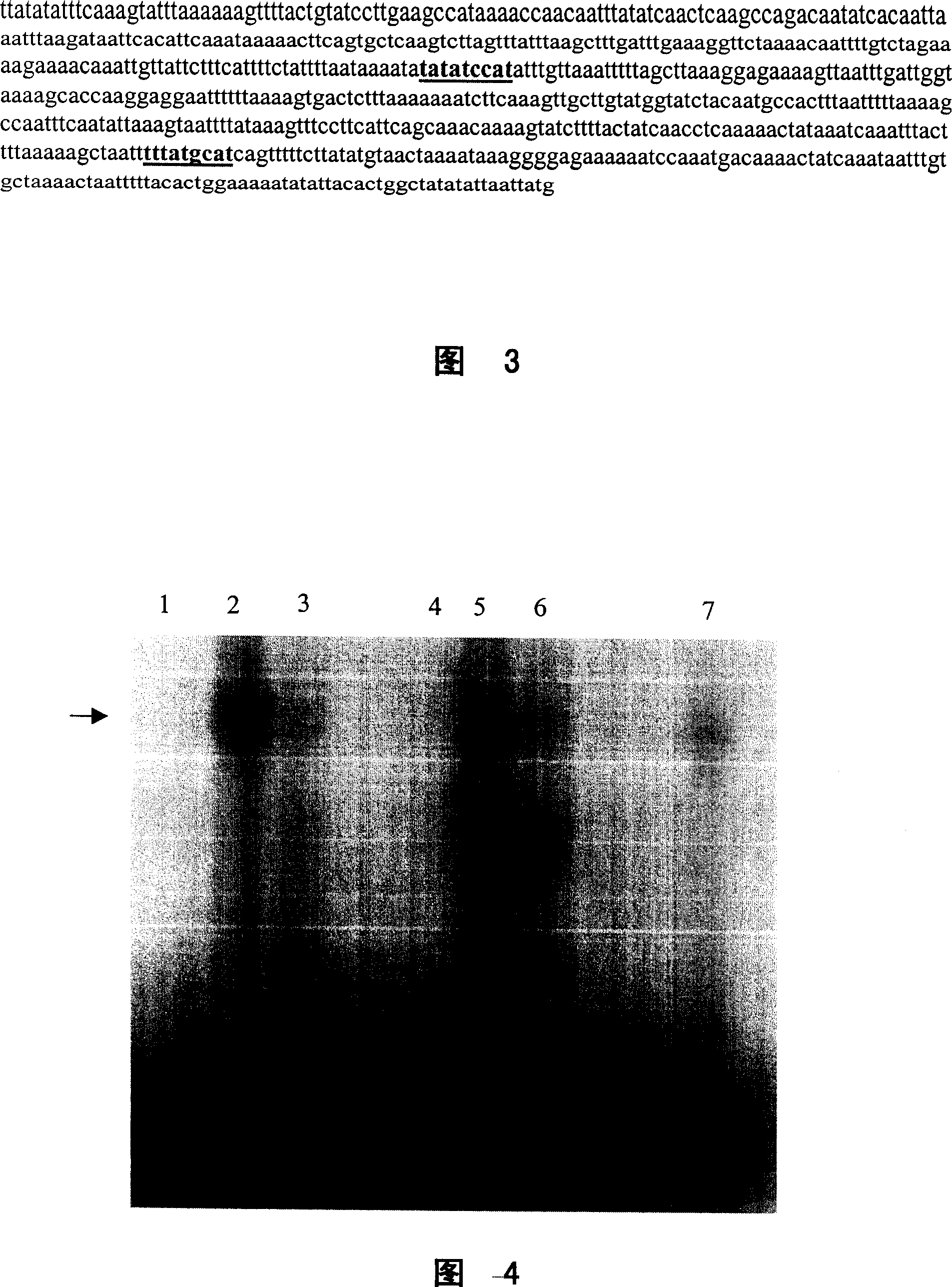 Monoclonal antibody for resisting human osteogenesis induction factor and its preparation method and uses