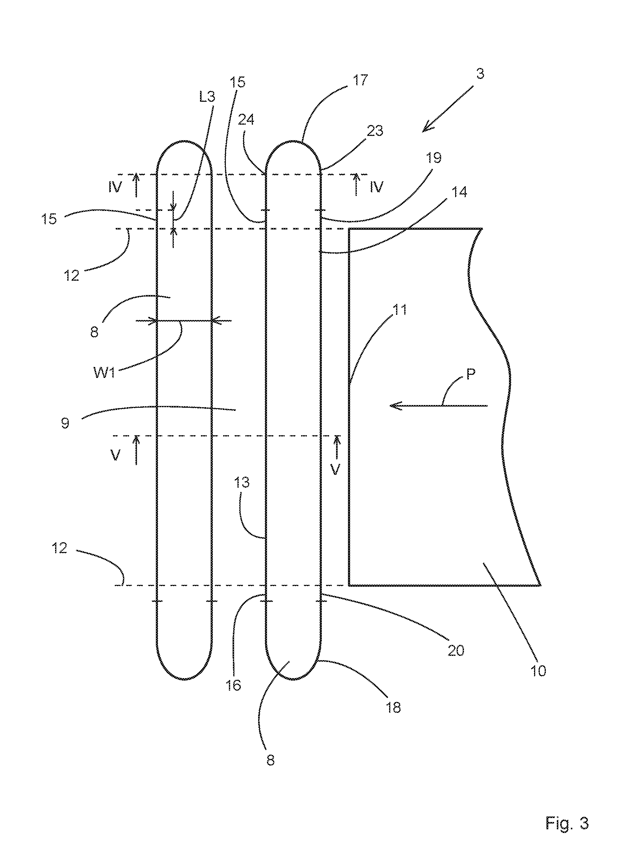 A shaving apparatus as well as a cutting unit for such a shavig apparatus