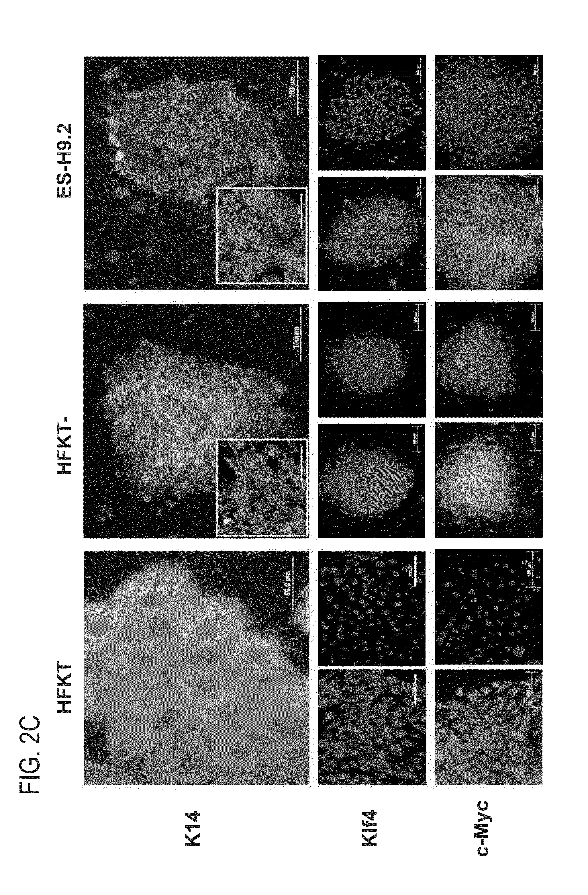 Method for generating induced pluripotent stem cells from keratinocytes derived from plucked hair follicles