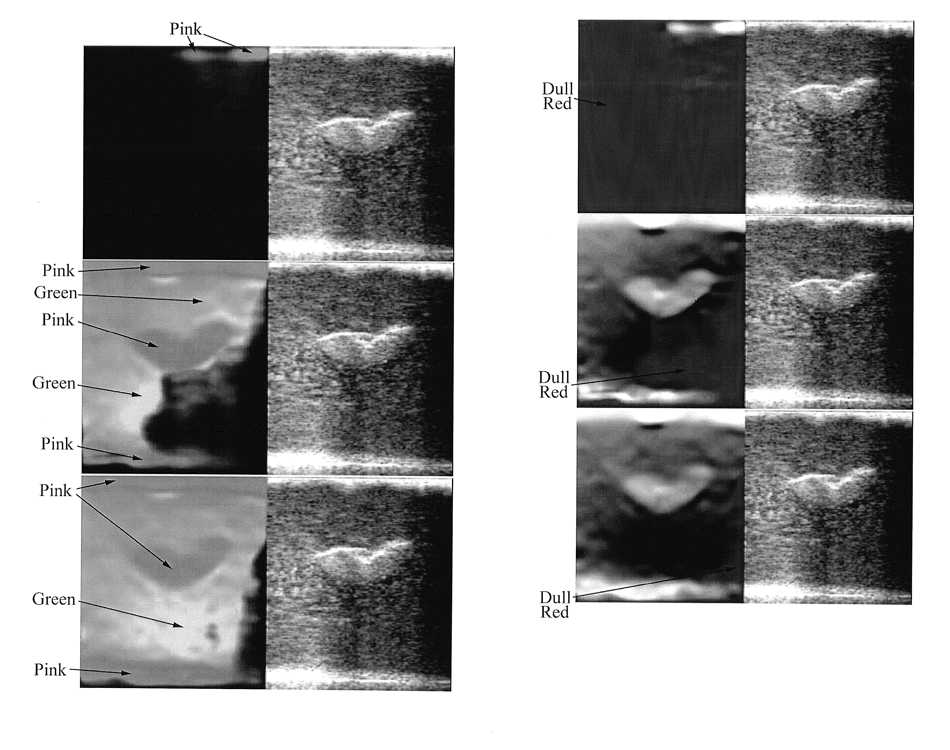 Strain Image Display Systems
