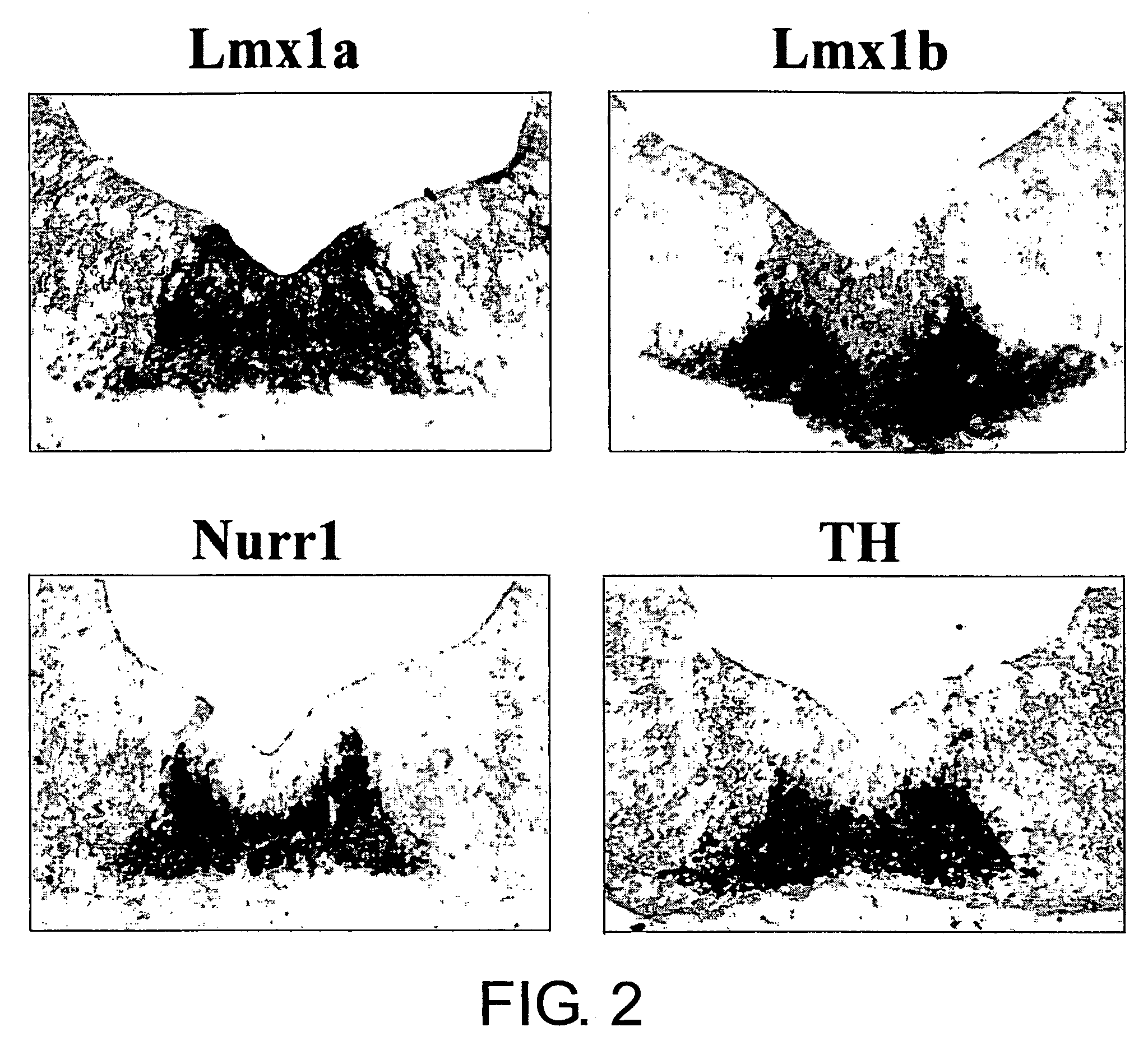 Specific marker Lmx1a on dopaminergic neurons