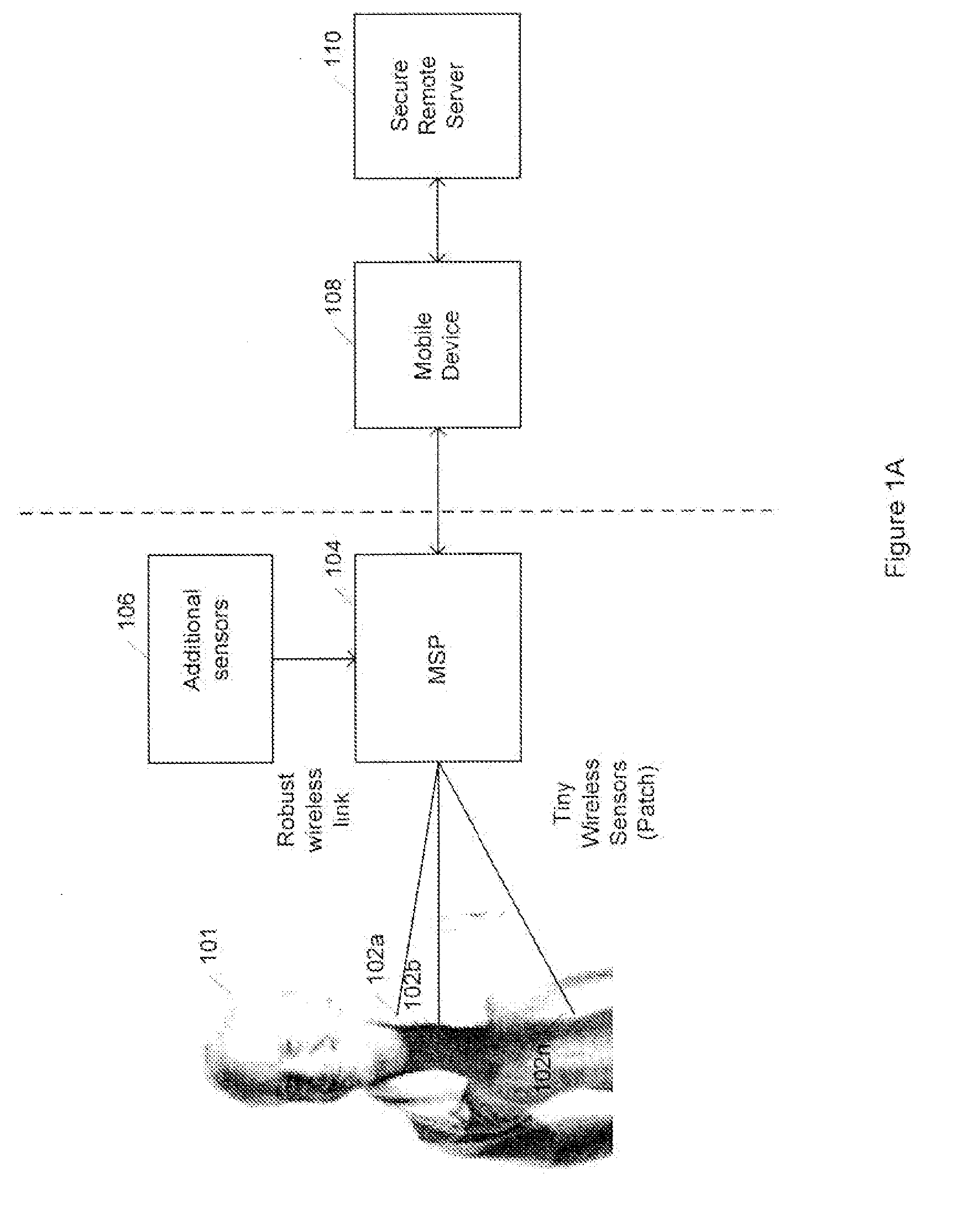 Medical signal processing system with distributed wireless sensors