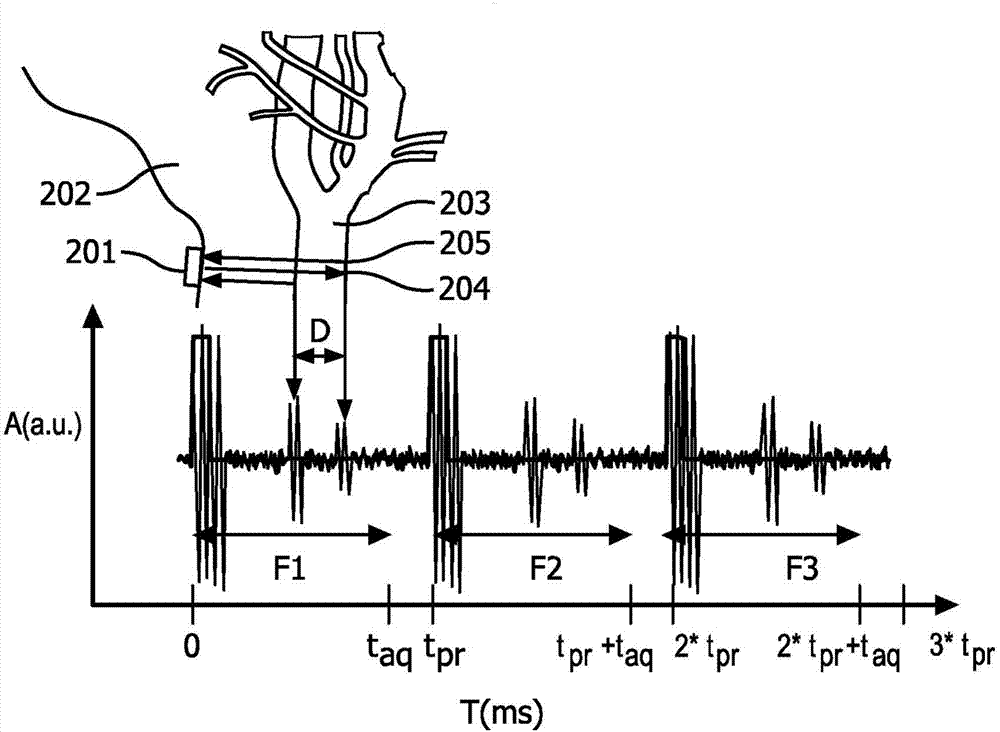 A system and a method for measuring arterial parameters