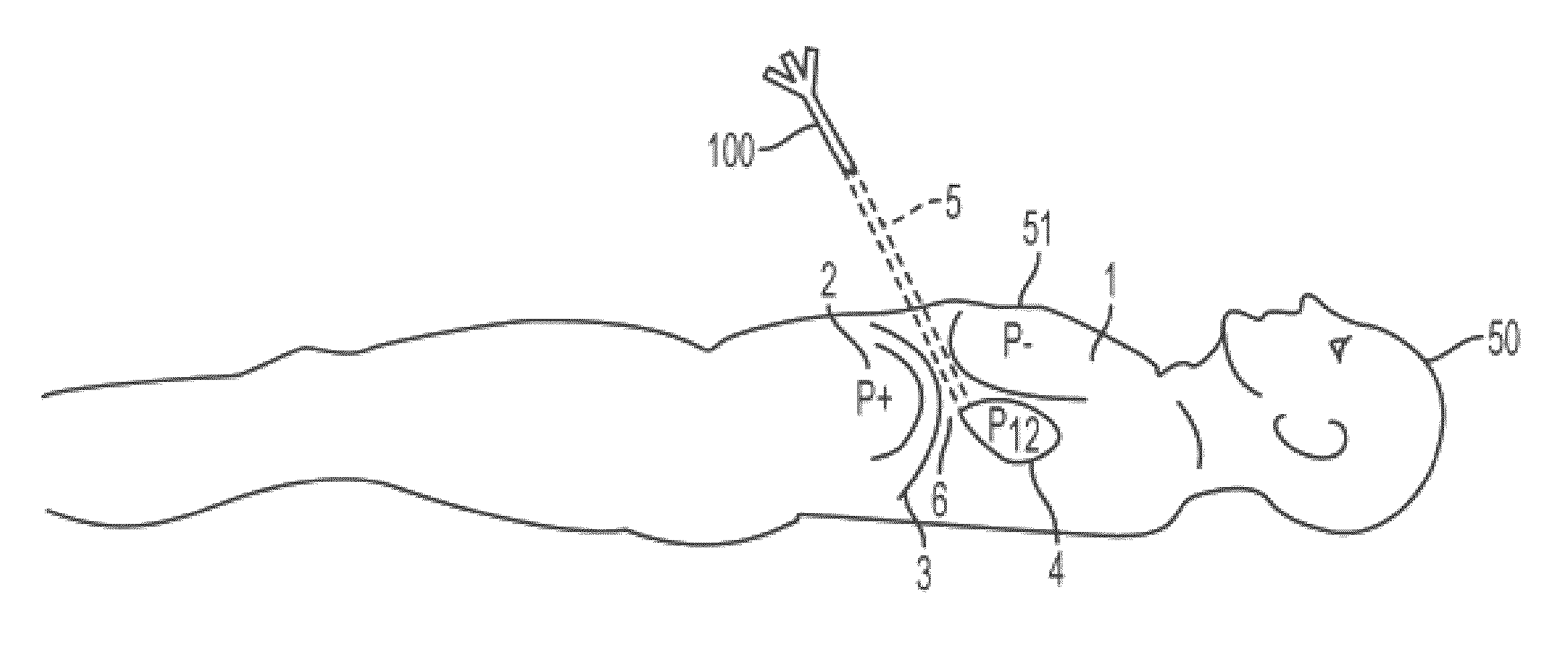 Access needle with direct visualization and related methods