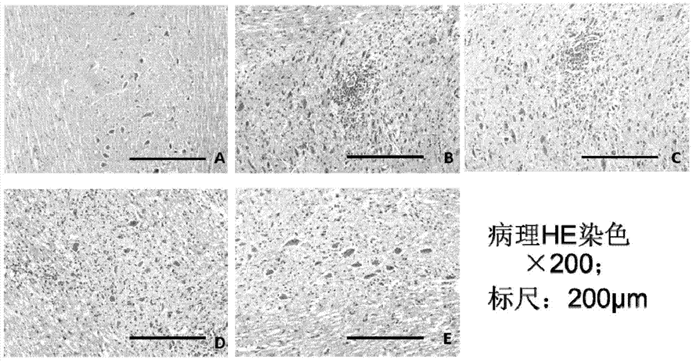 Pharmaceutical composition for treating inflammatory demyelinating diseases of central nervous system and application of combined administration thereof