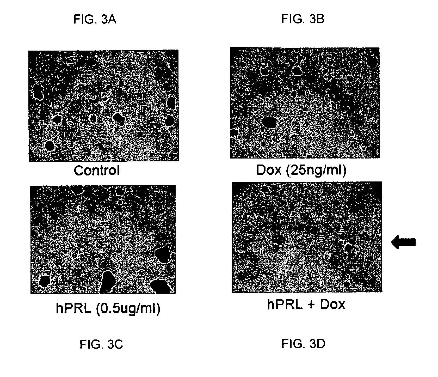 Method for sensitizing cancer stem cells to cancer therapy