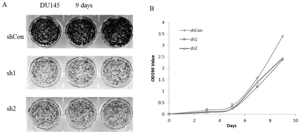 A stable cell line of du145 with low expression of gfpt1 and its construction and application