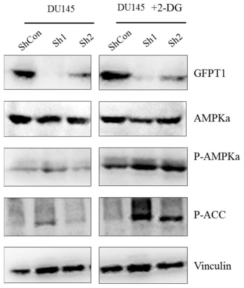 A stable cell line of du145 with low expression of gfpt1 and its construction and application