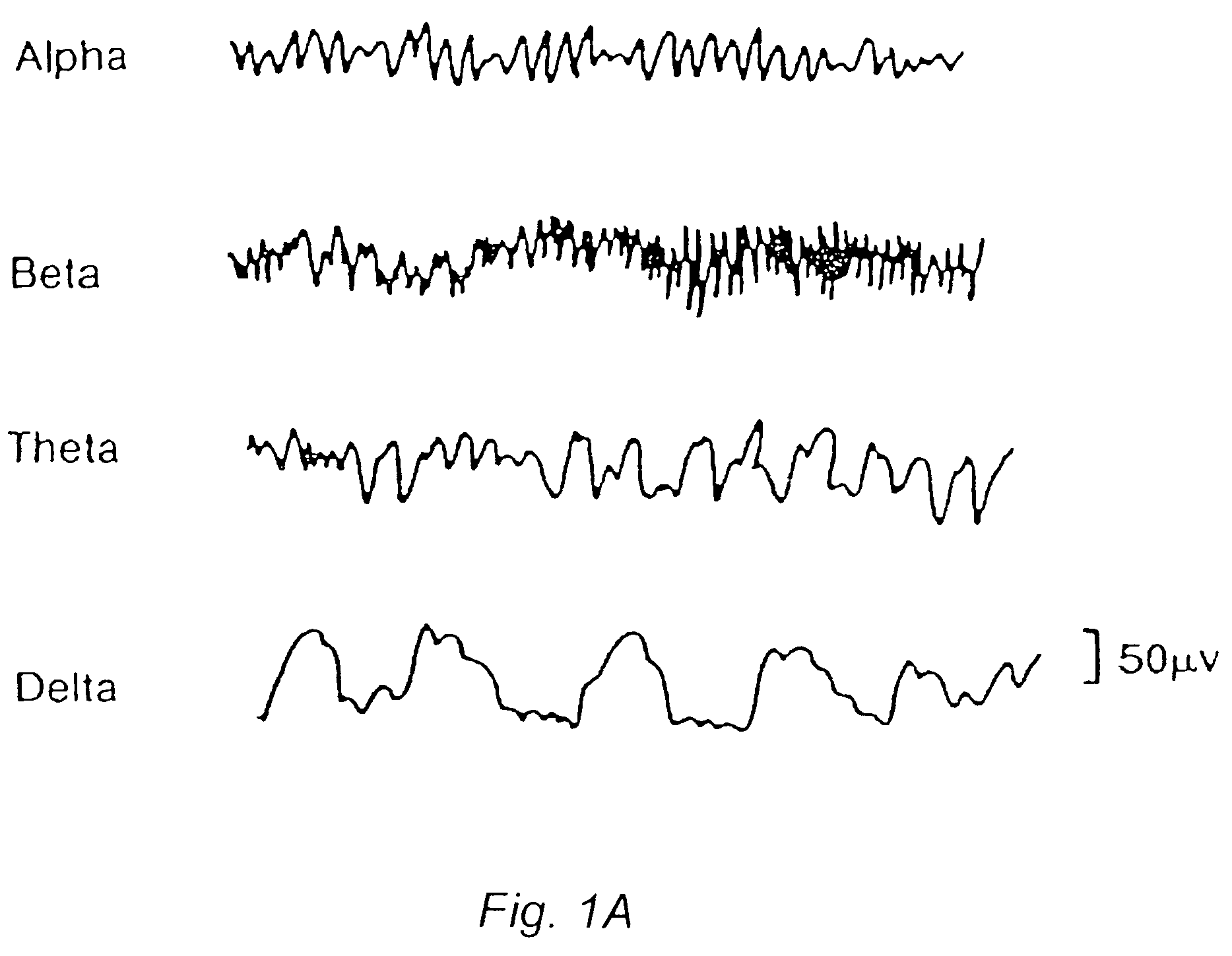 Method and system for analyzing and presenting an electroencephalogram (EEG)