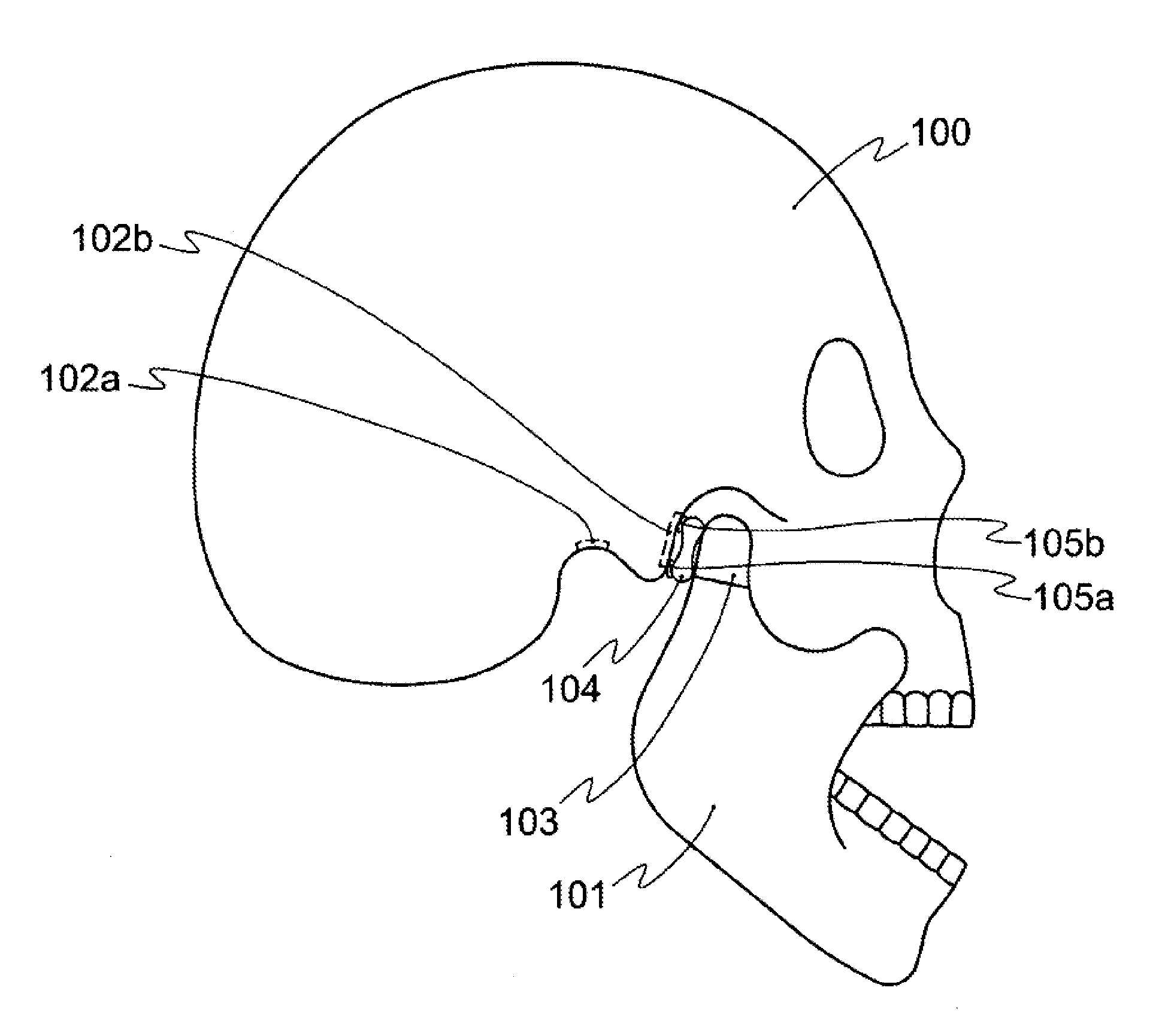 Anatomical model for training aid for learning reduction techniques and a method for learning the reduction techniques using the anatomical model for training aid