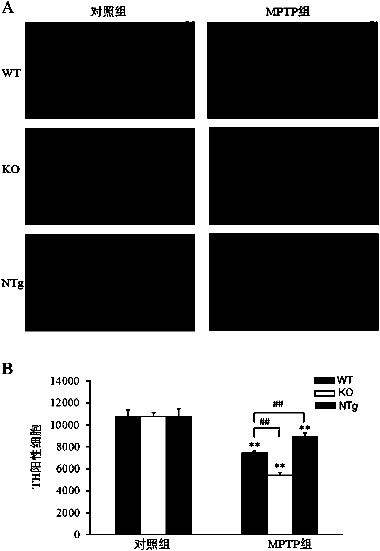 Function application of SH2B adapter protein 1 in treating Parkinson's disease