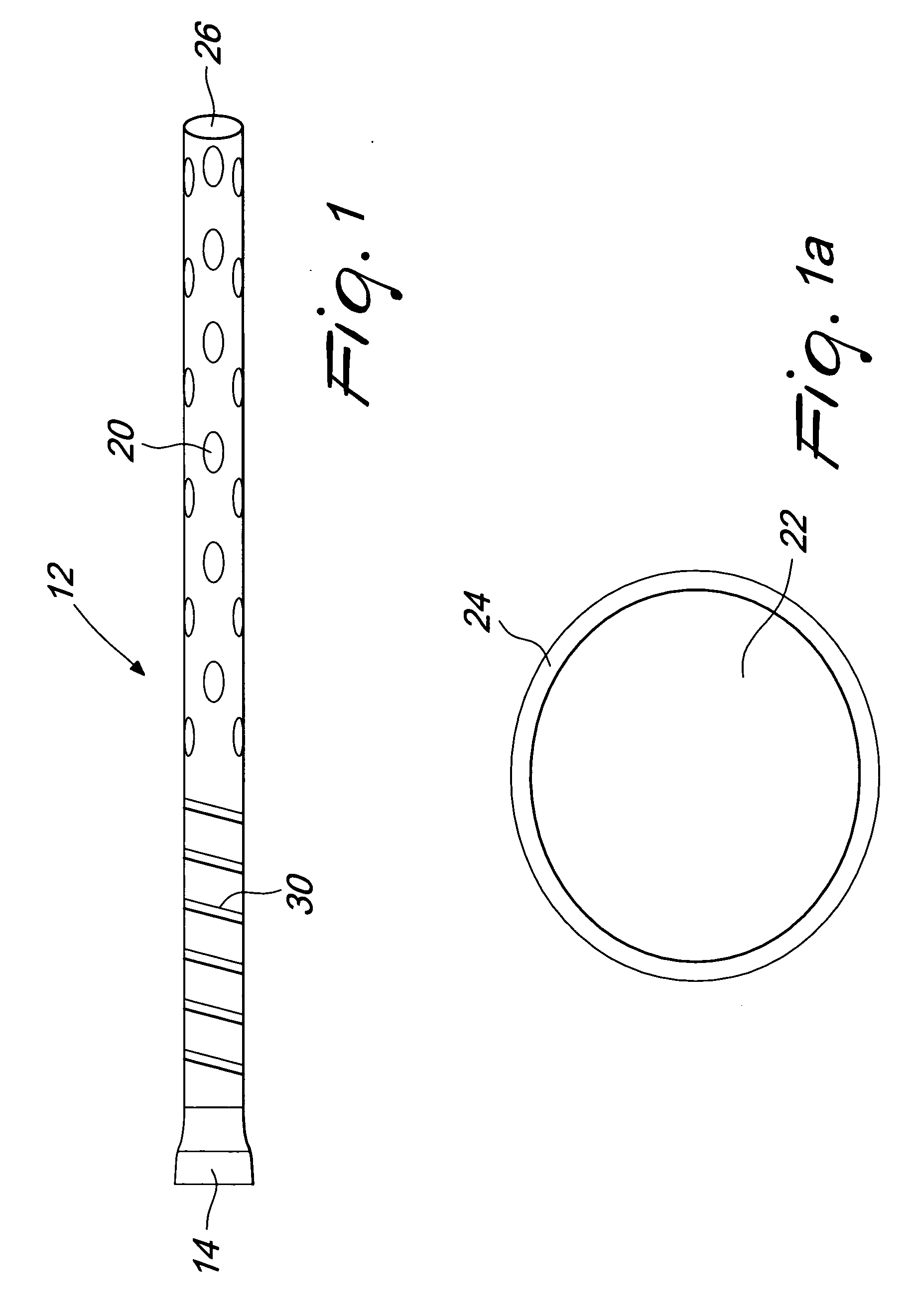 Method and apparatus for delayed pericardial drainage