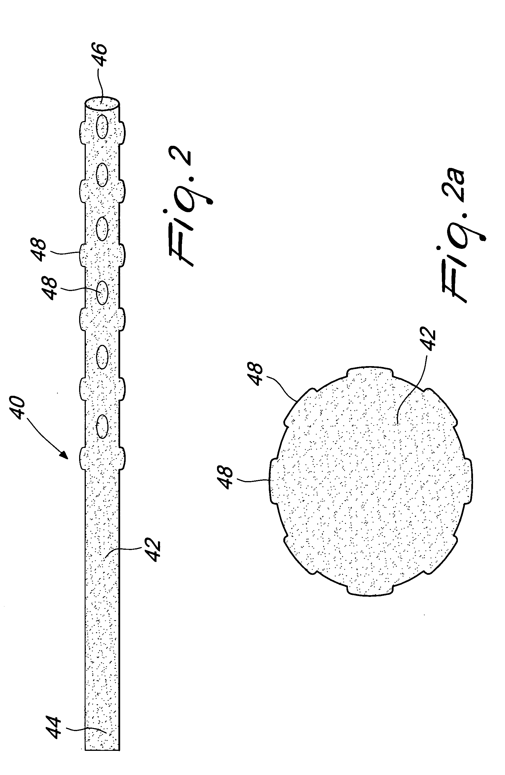 Method and apparatus for delayed pericardial drainage