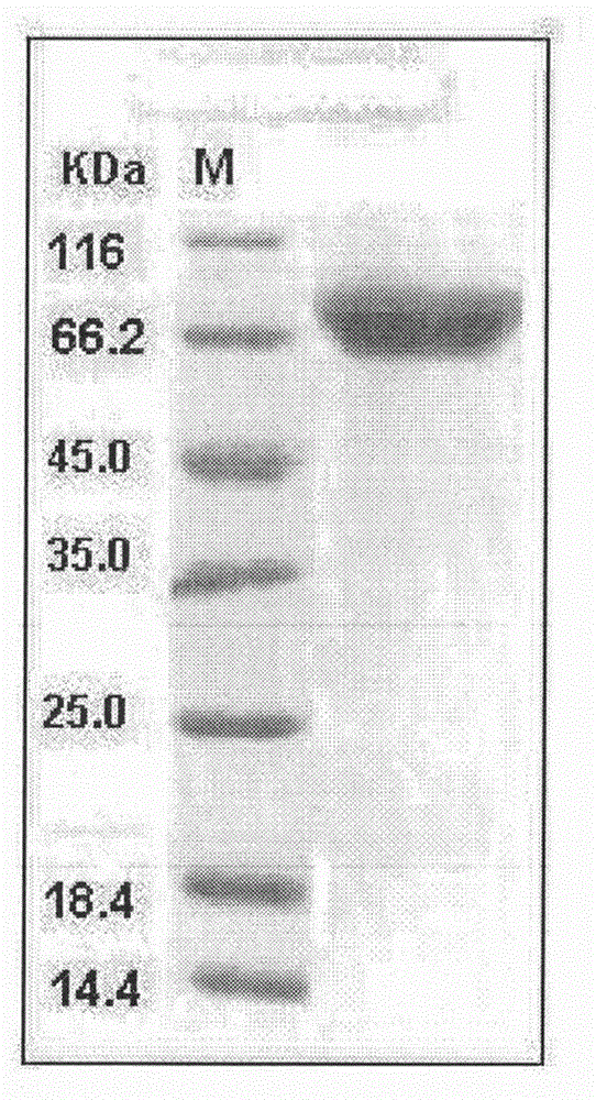 Recombinant ADAM15h fusion protein, preparation method and applications thereof