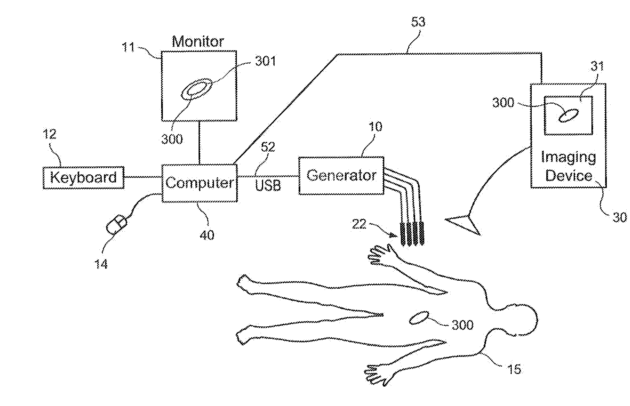 System and method for ablating a tissue site by electroporation with real-time pulse monitoring