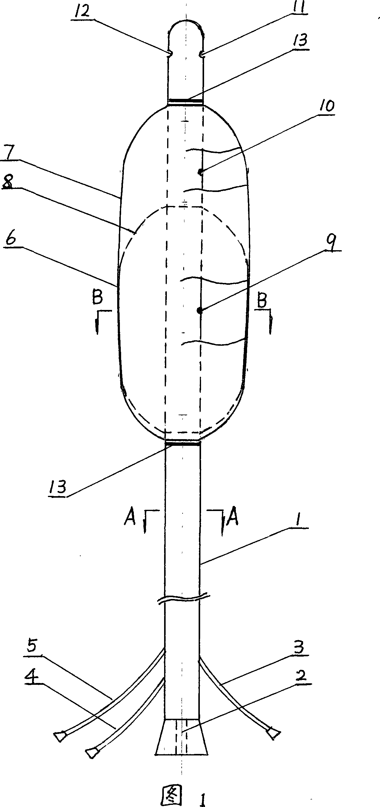 Multi-cavity high-pressure water-bag posterior urethral expanding catheter for treating hyperplasia of prostate