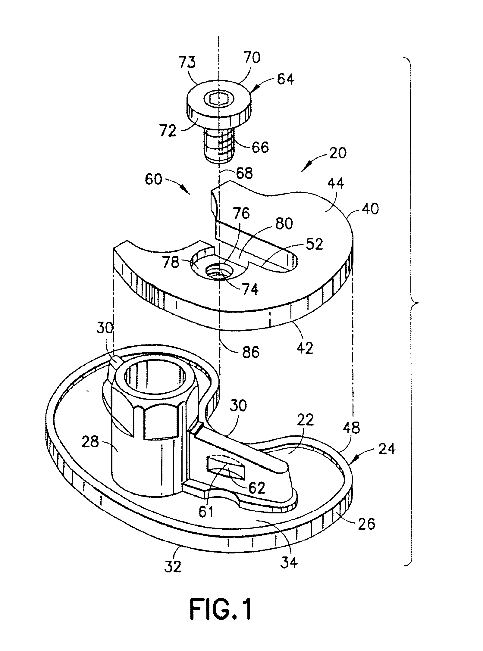 Securing an augment to a prosthetic implant component